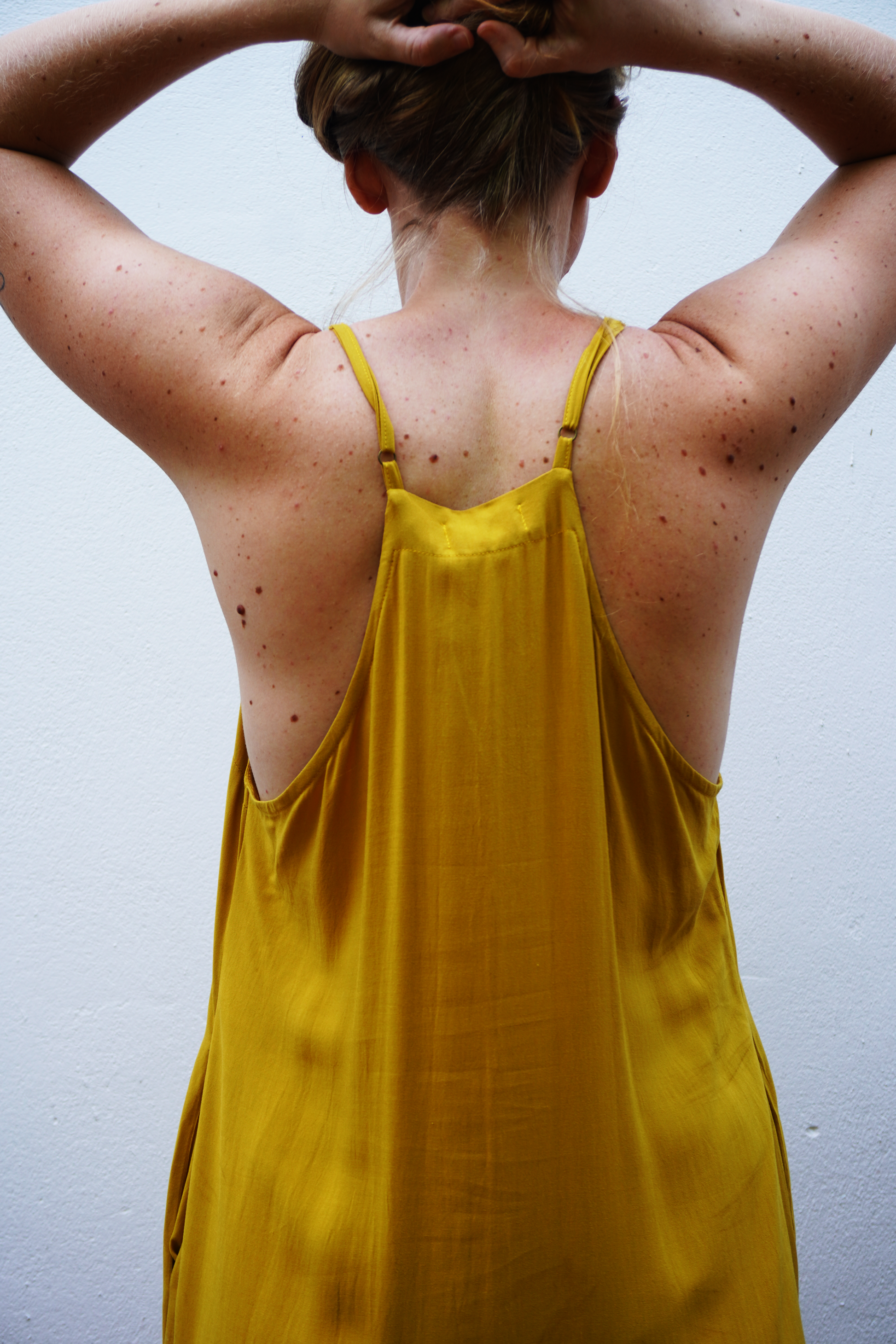 Person wearing a yellow dress with thin straps against a plain background